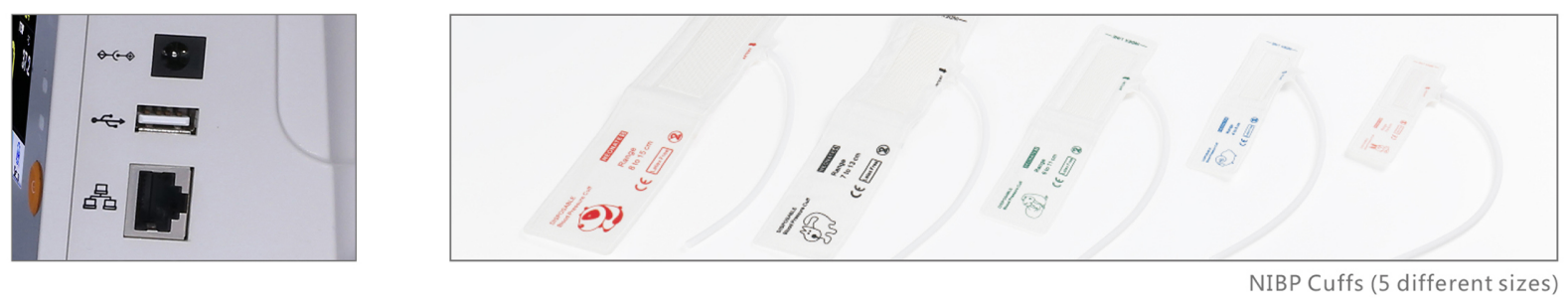 Medical Equipment Multi-parameter Veterinary Monitor Vital Signs Monitor With Rechargeable Battery details