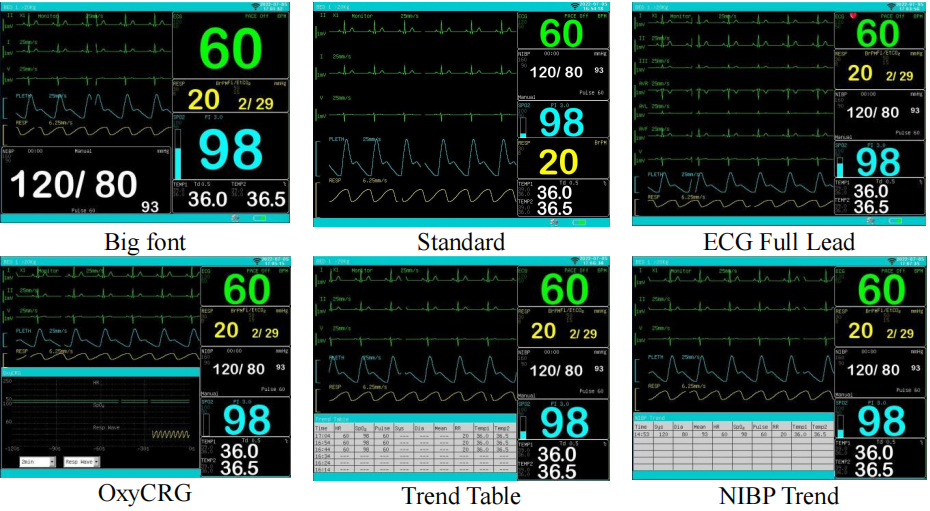 Portable Vet Multi-parameter Monitor Animals Medical Equipment 15inch Veterinary Monitor details