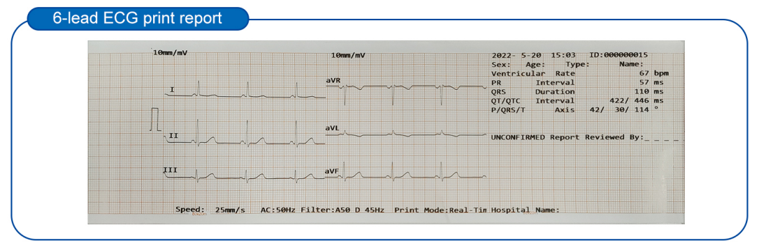 2024 hot selling 3-Channel 12-Lead Portable ECG Machine Animal Veterinary Medicine EKG Device for Veterinary Instrument Use manufacture