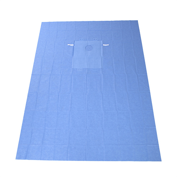 Побољшавање мера за контролу инфекција