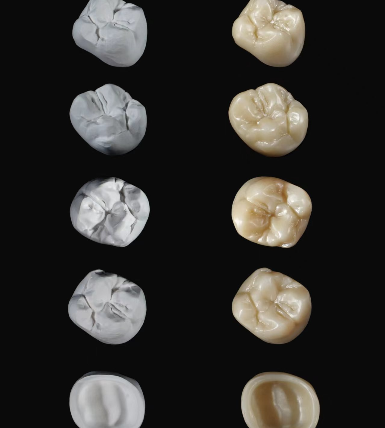 Crafting Excellence in Dental Crowns with DPS Dental