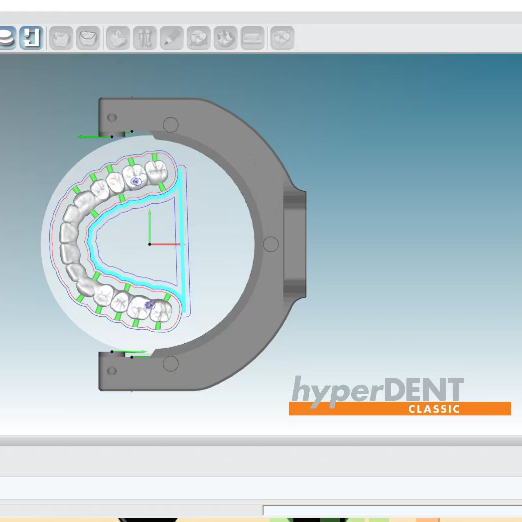 DPS Dental Introduces exocad Dental Software Products