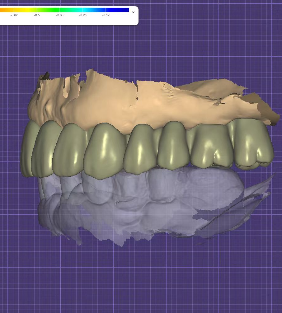 Advanced Training and Support for exocad Users at DPS Dental