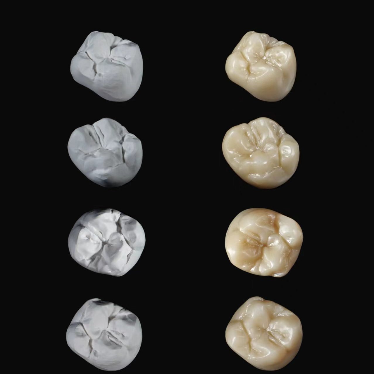 Premium Dental Crowns by DPS Dental