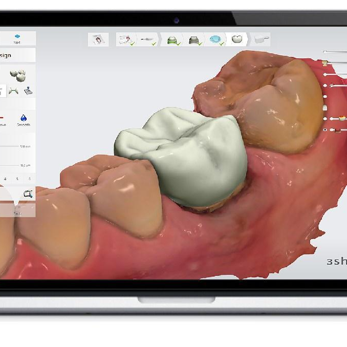 Advanced 3Shape Dental Design Software by DPS Dental