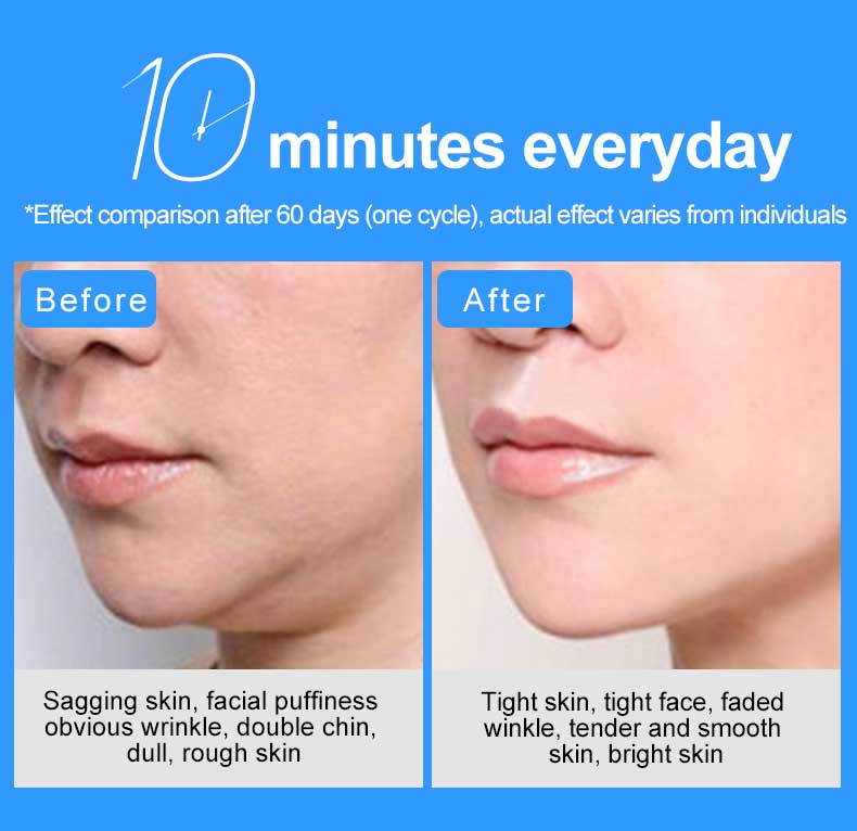 3d-roller-massager-14 3d facial massage roller 1501 manufacture