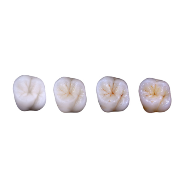 Consigli per scegliere i blocchi Zirconia CAD CAM più adatti per il tuo studio odontoiatrico o laboratorio.