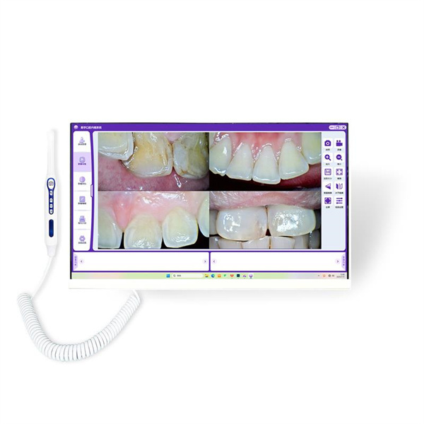 تصویرسازی راهتان را به سمت سلامت دندانی بهتر با یک دوربین دندانی نشان دهد