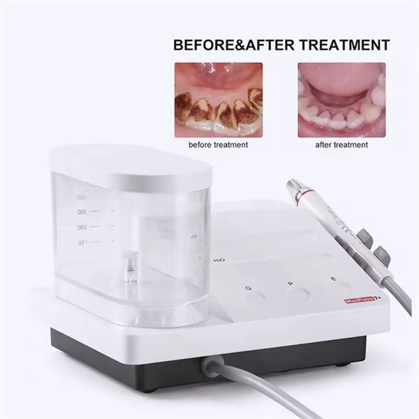 کدام یک بهتر است؟