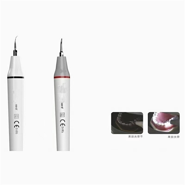 اسکیلر دندان اولتراسنگ را بخشی از روتین شما کنید