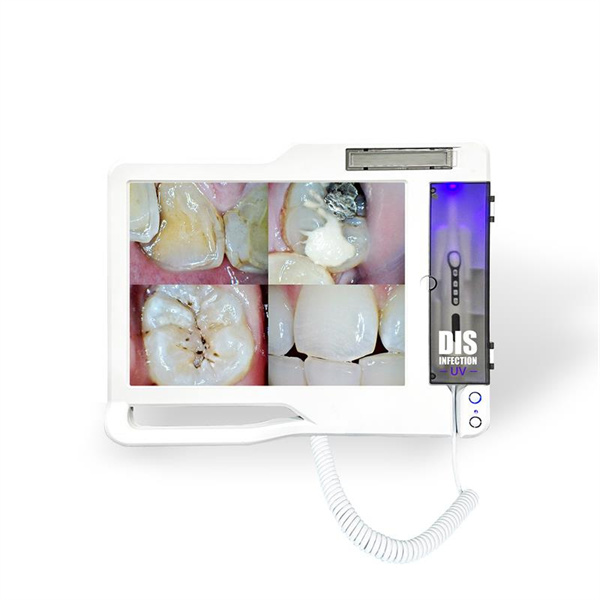 چگونه دوربینهای دندانی فرآیند درمان را تسریع میکنند