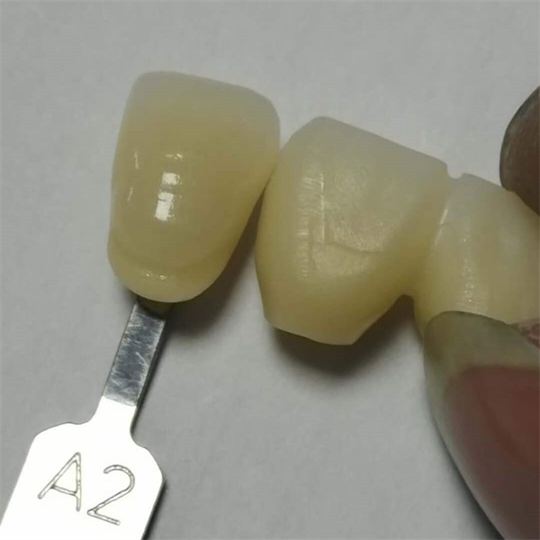 สิ่งที่ทำให้บล็อกเซอร์โคเนียทางทันตกรรมของเราแตกต่างจากคู่แข่งคืออะไร