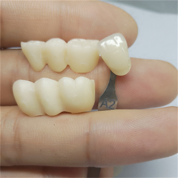 Perché i blocchi in zirconia CAD/CAM sono la scelta migliore per i professionisti odontoiatrici