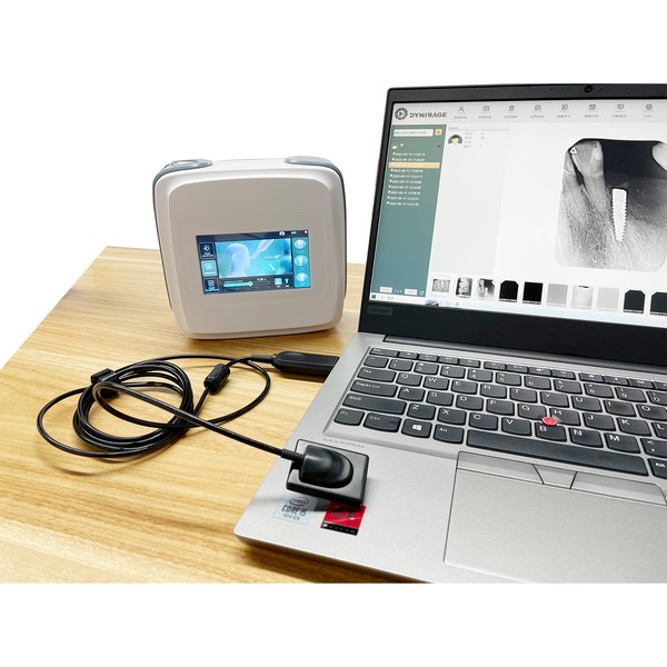 Wat zijn de voordelen van het gebruik van een tandarts röntgensensor in tandartspraktijken