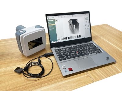 Choosing the Right Dental X-Ray Machine: A Guide for Dental Practices
