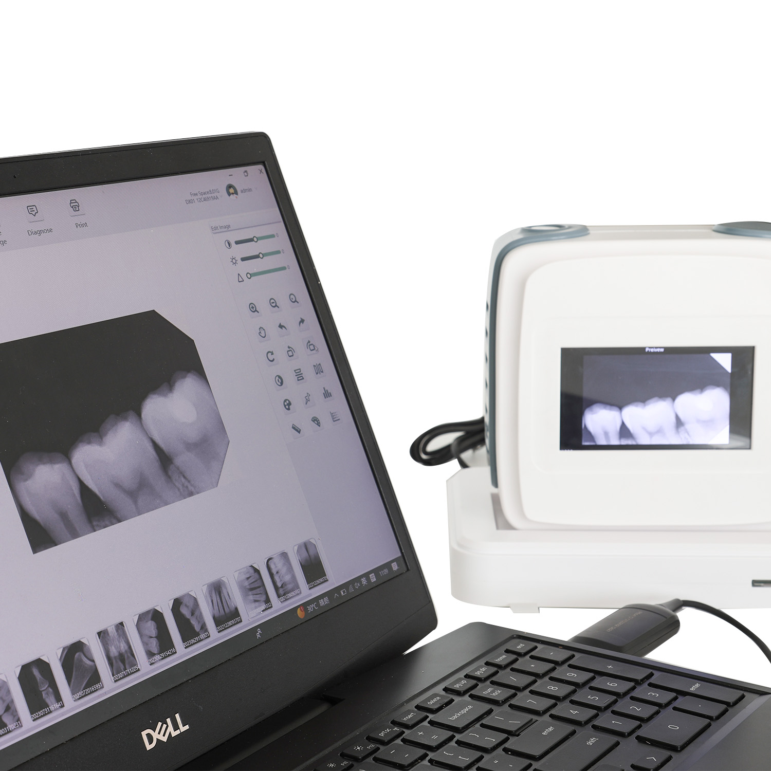 O prezentare generală a funcțiilor avansate ale mașinilor de raze X digitale