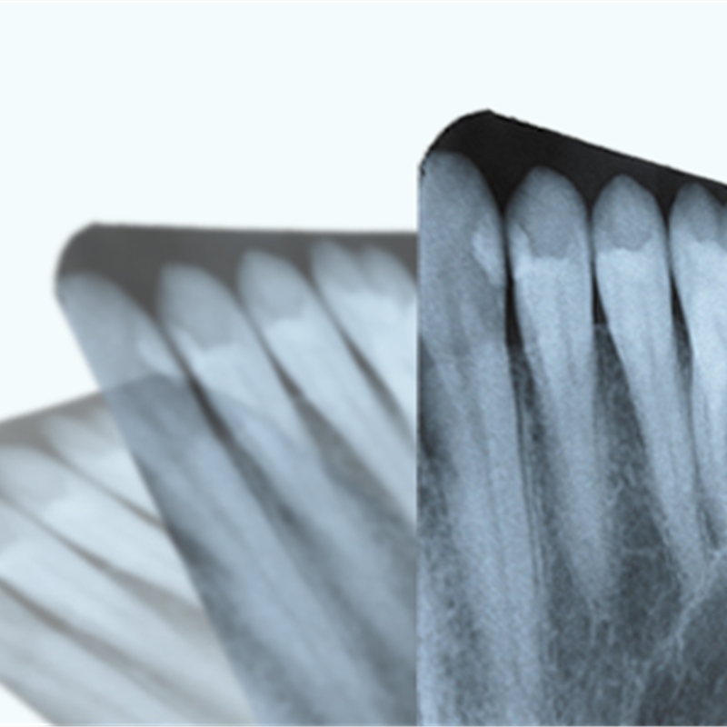 เครื่องกัดที่ทนทานและเชื่อถือได้สูง ใช้งานได้ยาวนาน