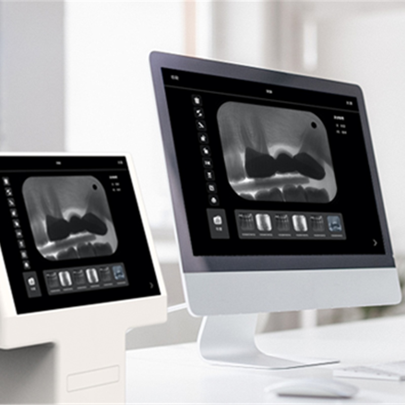 Wydoskonalanie diagnostyki stomatologicznej za pomocą przenośnych aparatur rentgenowych