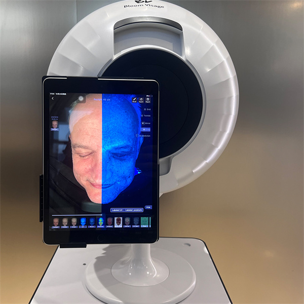 Entdecken Sie Sofort Hautprobleme mit SkinAnalyser