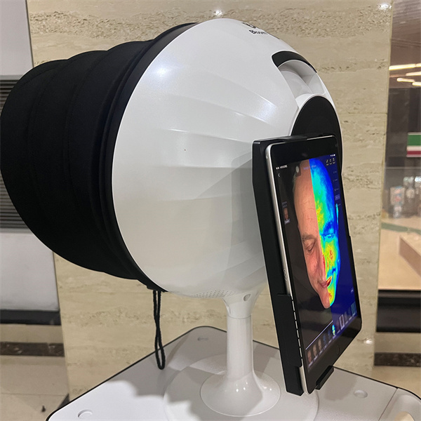 Зашто једноставна фотографија може много рећи о здрављу ваше коже