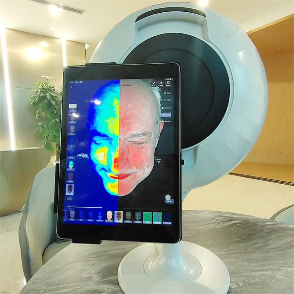 Виявляйте рак шкіри ранше за допомогою сучасного обладнання для екранування