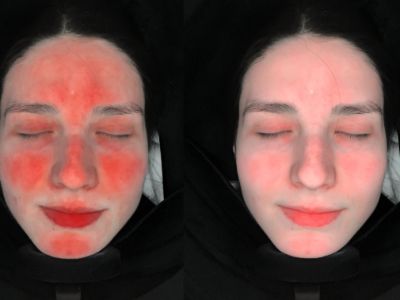 5 Factors for Choosing AI Skin Analyzer Suppliers