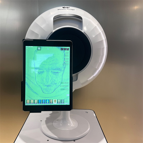 Erreichen Sie Perfekte Haut mit SkinAnalyser