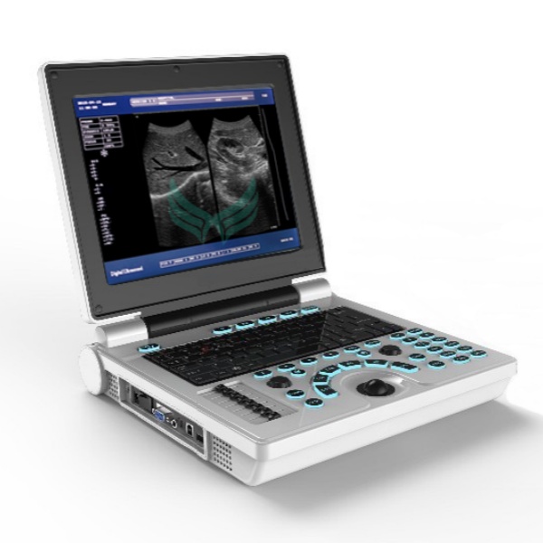Security of Portable Digital Ultrasound Machines