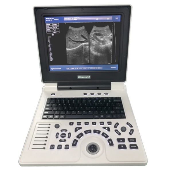 Innovation of Portable Digital Ultrasound Machines