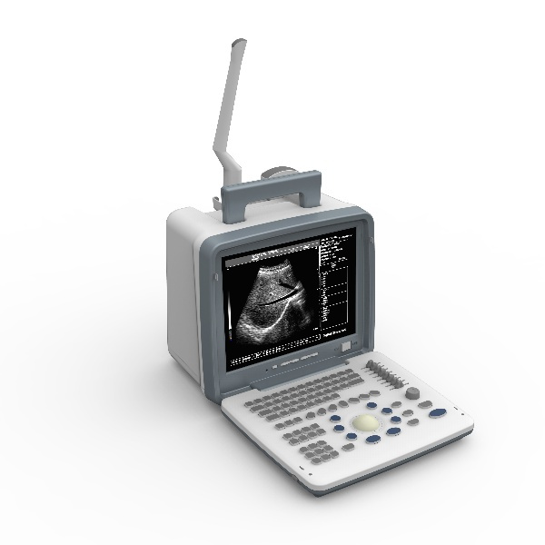 How Ultrasound Scans are Paving the Way for Early Diagnosis?