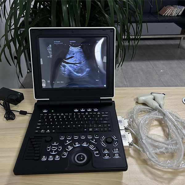 A Comprehensive Guide to Ultrasound's Versatile Applications