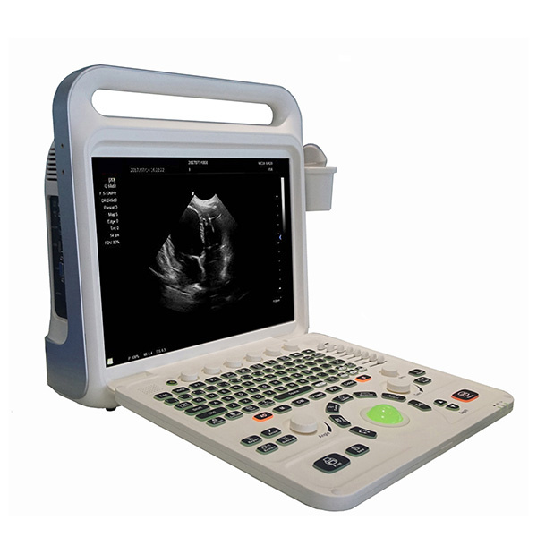 Innovation in Digital Ultrasound Machines