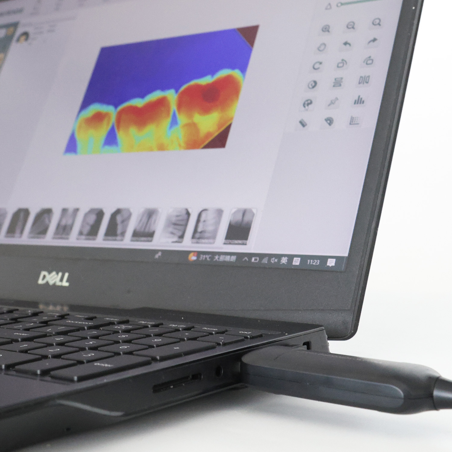 Überholen Sie die Konkurrenz mit fortschrittlichen dentalen Fräsmaschinen