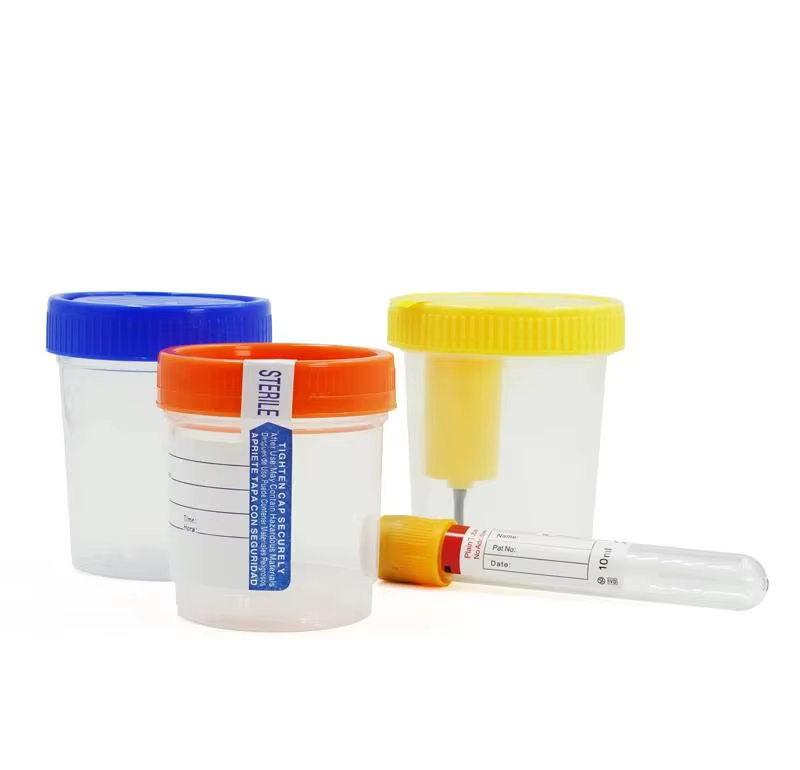 Vacuum Urine Container: Why It’s Essential for Sterile Urine Specimen Collection