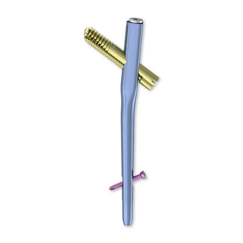 The Benefits of Ankle Spanning External Fixators