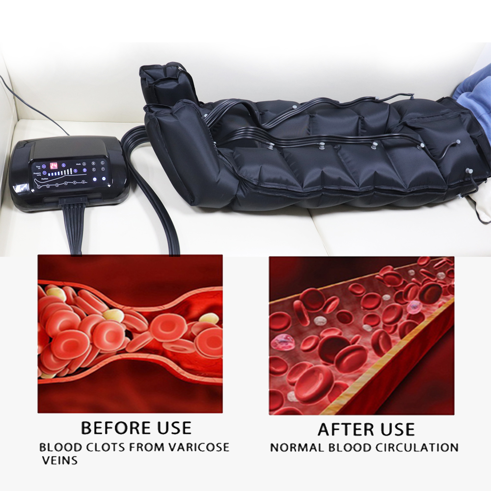 טכנולוגיהכנולוגיה מתקדמת לדחיסה