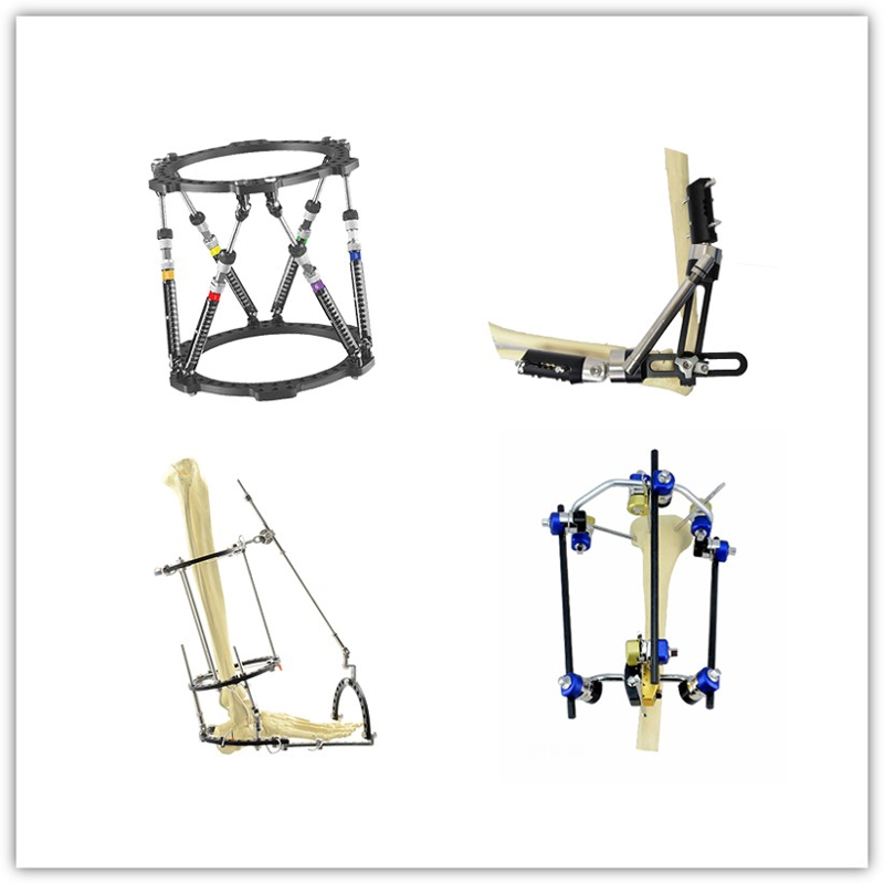 https://okki-shop.oss-cn-hangzhou.aliyuncs.com/category/83036/2966/324b50d30d9f3e0f82f7c770b21d93bc/External%20Fixator%20System.jpg