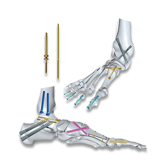 Cannulated Screws