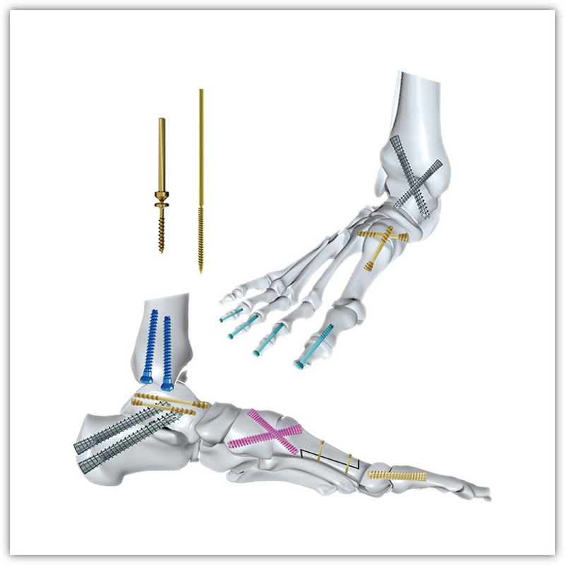 https://okki-shop.oss-cn-hangzhou.aliyuncs.com/category/83036/2966/967975016dce24818e62045b24477d0d/Pins%26Screws.jpg